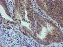 Immunohistochemistry (Formalin/PFA-fixed paraffin-embedded sections) - Anti-PGM3 antibody [OTI1A11] (AB128094)