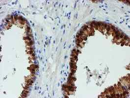 Immunohistochemistry (Formalin/PFA-fixed paraffin-embedded sections) - Anti-PGM3 antibody [OTI1A11] (ab128094), expandable thumbnail