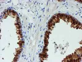 Immunohistochemistry (Formalin/PFA-fixed paraffin-embedded sections) - Anti-PGM3 antibody [OTI1A11] (AB128094)