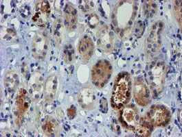 Immunohistochemistry (Formalin/PFA-fixed paraffin-embedded sections) - Anti-PGM3 antibody [OTI1A11] (AB128094)