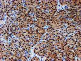 Immunohistochemistry (Formalin/PFA-fixed paraffin-embedded sections) - Anti-PGM3 antibody [OTI1A11] (AB128094), expandable thumbnail