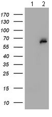 Western blot - Anti-PGM3 antibody [OTI1A11] (AB128094), expandable thumbnail