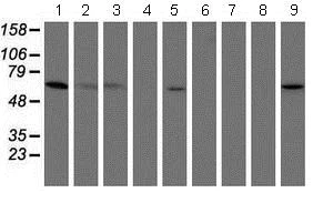 Western blot - Anti-PGM3 antibody [OTI1A11] (AB128094)