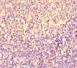 Immunohistochemistry (Formalin/PFA-fixed paraffin-embedded sections) - Anti-PGP antibody (AB234884), expandable thumbnail