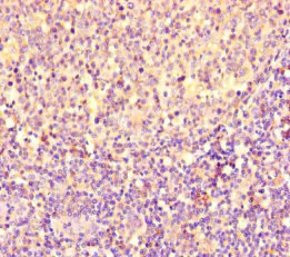 Immunohistochemistry (Formalin/PFA-fixed paraffin-embedded sections) - Anti-PGP antibody (AB234884)