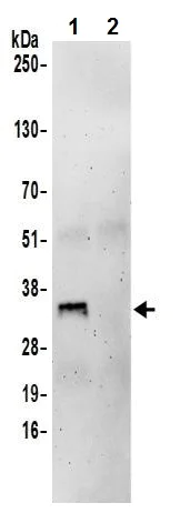 Immunoprecipitation - Anti-PGP antibody (AB242104)