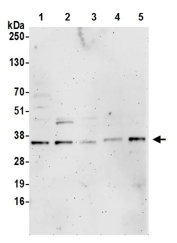 Western blot - Anti-PGP antibody (AB242104)