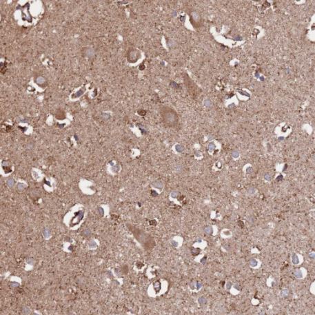 Immunohistochemistry (Formalin/PFA-fixed paraffin-embedded sections) - Anti-PGP antibody (AB261736), expandable thumbnail