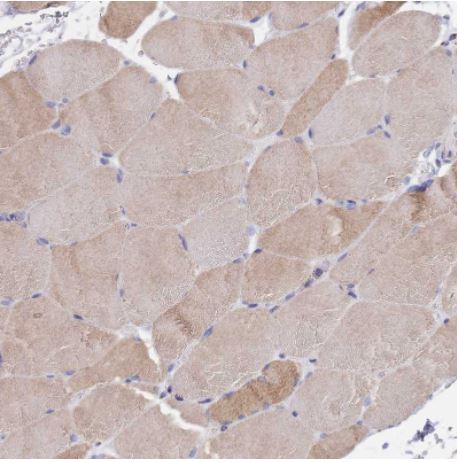 Immunohistochemistry (Formalin/PFA-fixed paraffin-embedded sections) - Anti-PGP antibody (AB261736), expandable thumbnail