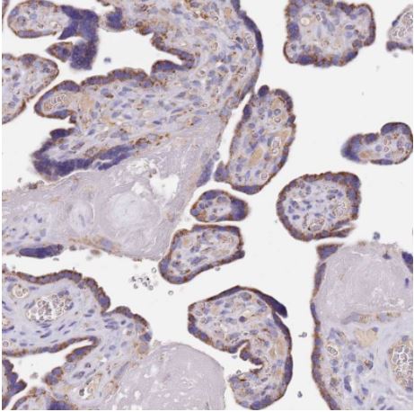 Immunohistochemistry (Formalin/PFA-fixed paraffin-embedded sections) - Anti-PGP antibody (AB261736), expandable thumbnail