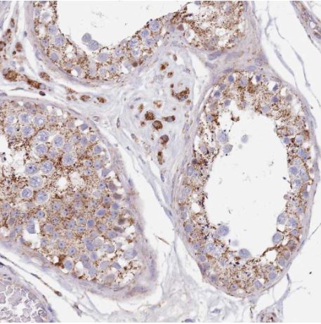 Immunohistochemistry (Formalin/PFA-fixed paraffin-embedded sections) - Anti-PGP antibody (AB261736), expandable thumbnail