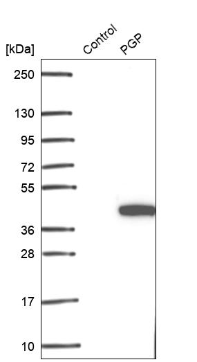 Western blot - Anti-PGP antibody (ab261736), expandable thumbnail