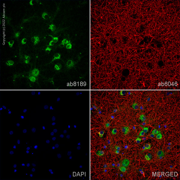 Immunocytochemistry - Anti-PGP9.5 antibody [13C4 / I3C4] (AB8189), expandable thumbnail