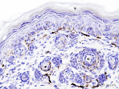 Immunohistochemistry (Formalin/PFA-fixed paraffin-embedded sections) - Anti-PGP9.5 antibody [13C4 / I3C4] (AB8189), expandable thumbnail