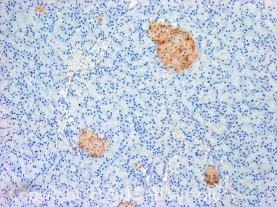 Immunohistochemistry (Formalin/PFA-fixed paraffin-embedded sections) - Anti-PGP9.5 antibody [13C4 / I3C4] (ab8189), expandable thumbnail