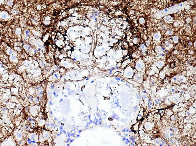 Immunohistochemistry (Formalin/PFA-fixed paraffin-embedded sections) - Anti-PGP9.5 antibody [13C4 / I3C4] (AB8189), expandable thumbnail