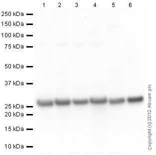 Western blot - Anti-PGP9.5 antibody [13C4 / I3C4] - Neuronal Marker (AB8189), expandable thumbnail