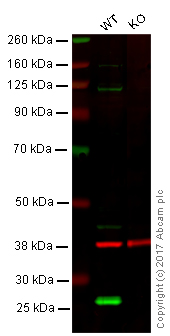 Western blot - Anti-PGP9.5 antibody [13C4 / I3C4] - Neuronal Marker (ab8189), expandable thumbnail