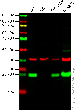 Western blot - Anti-PGP9.5 antibody [31A3] (AB20559)