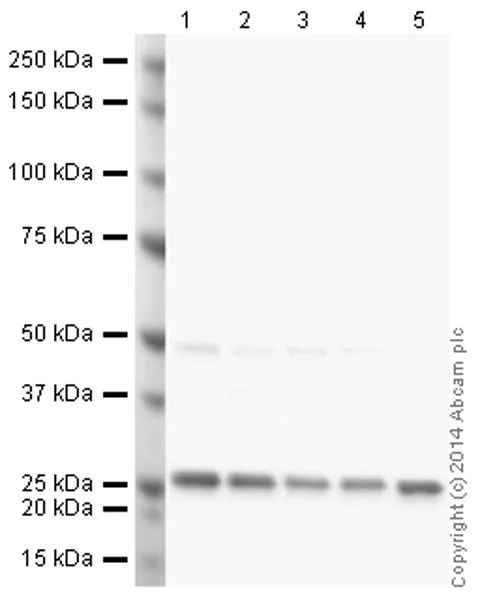 Western blot - Anti-PGP9.5 antibody [31A3] (AB20559)