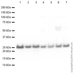 Western blot - Anti-PGP9.5 antibody [346CT2.5.1] - Neuronal Marker (AB86808), expandable thumbnail