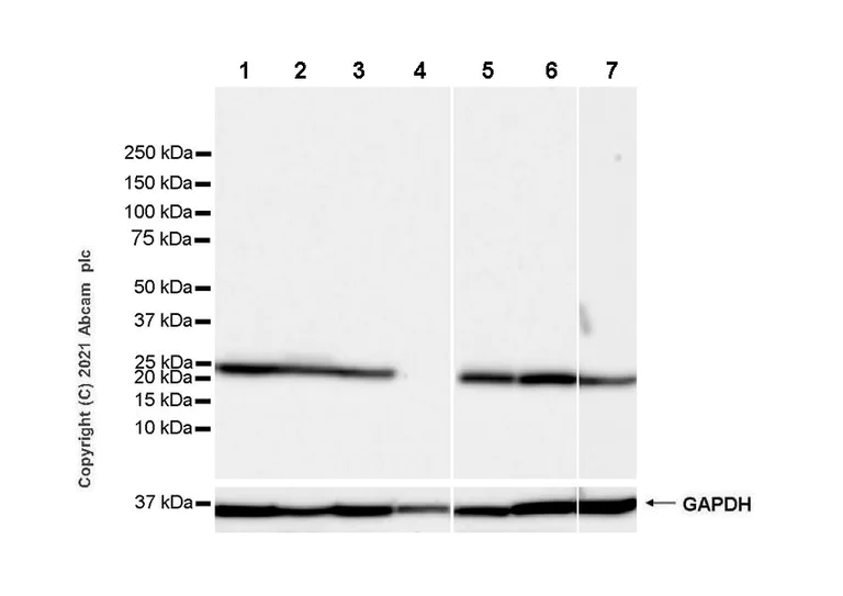 Western blot - Anti-PGP9.5 antibody [346CT2.5.1] - Neuronal Marker (AB86808)