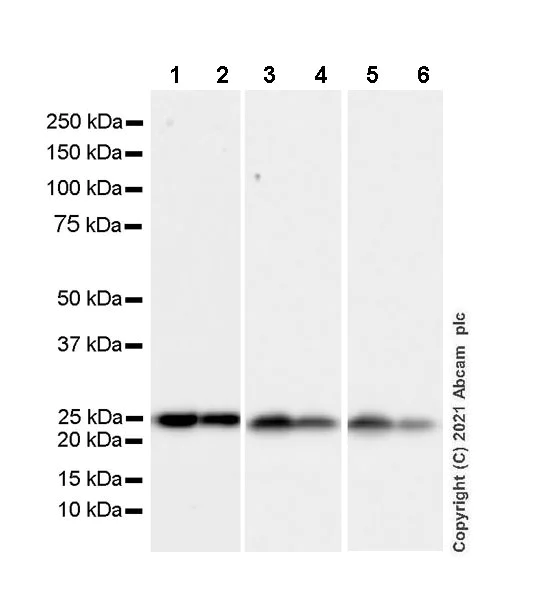 Western blot - Anti-PGP9.5 antibody [346CT2.5.1] - Neuronal Marker (AB86808)