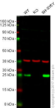 Western blot - Anti-PGP9.5 antibody [346CT2.5.1] - Neuronal Marker (AB86808), expandable thumbnail