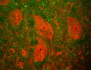 Immunocytochemistry/ Immunofluorescence - Anti-PGP9.5 antibody [BH7] - Neuronal Marker (AB72911), expandable thumbnail