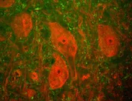 Immunocytochemistry/ Immunofluorescence - Anti-PGP9.5 antibody [BH7] - Neuronal Marker (AB72911)