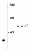 Western blot - Anti-PGP9.5 antibody [BH7] - Neuronal Marker (AB72911), expandable thumbnail