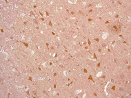 Immunohistochemistry (Formalin/PFA-fixed paraffin-embedded sections) - Anti-PGP9.5 antibody [EPR4117] - BSA and Azide free (AB176838), expandable thumbnail
