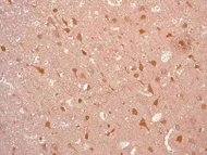 Immunohistochemistry (Formalin/PFA-fixed paraffin-embedded sections) - Anti-PGP9.5 antibody [EPR4117] - BSA and Azide free - Neuronal Marker (AB176838)