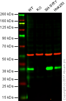 Western blot - Anti-PGP9.5 antibody [EPR4117] - BSA and Azide free - Neuronal Marker (AB176838), expandable thumbnail