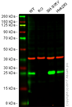 Western blot - Anti-PGP9.5 antibody [EPR4117] - Neuronal Marker (AB109261), expandable thumbnail