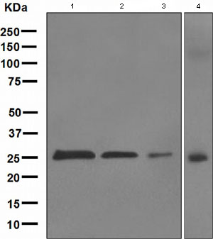 Western blot - Anti-PGP9.5 antibody [EPR4117] - Neuronal Marker (AB109261), expandable thumbnail