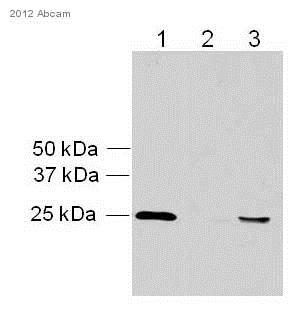 Western blot - Anti-PGP9.5 antibody [EPR4117] - Neuronal Marker (AB109261), expandable thumbnail