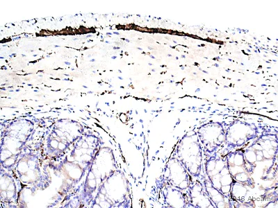 Immunohistochemistry (Formalin/PFA-fixed paraffin-embedded sections) - Anti-PGP9.5 antibody [EPR4118] - BSA and Azide free (AB220823)