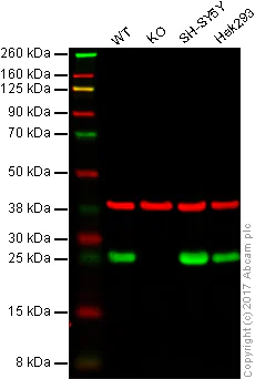 Western blot - Anti-PGP9.5 antibody [EPR4118] - BSA and Azide free (AB220823)