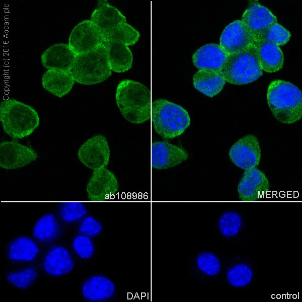 Immunocytochemistry/ Immunofluorescence - Anti-PGP9.5 antibody [EPR4118] - Neuronal Marker (AB108986)