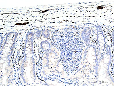 Immunohistochemistry (Formalin/PFA-fixed paraffin-embedded sections) - Anti-PGP9.5 antibody [EPR4118] - Neuronal Marker (AB108986)