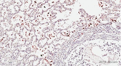 Immunohistochemistry (Formalin/PFA-fixed paraffin-embedded sections) - Anti-PGP9.5 antibody [EPR4118] - Neuronal Marker (ab108986), expandable thumbnail