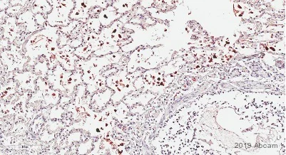 Immunohistochemistry (Formalin/PFA-fixed paraffin-embedded sections) - Anti-PGP9.5 antibody [EPR4118] - Neuronal Marker (AB108986)