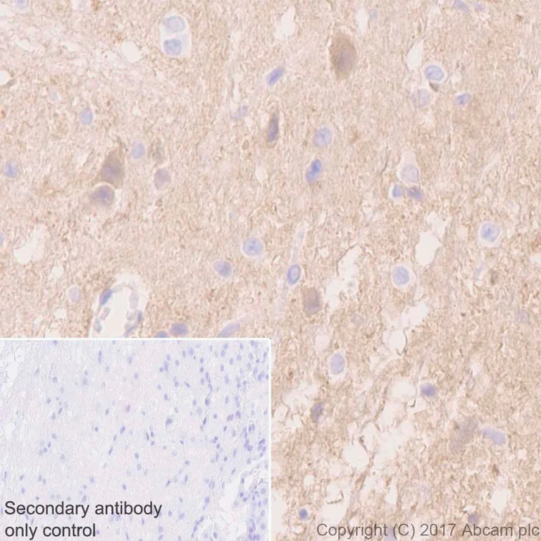 Immunohistochemistry (Formalin/PFA-fixed paraffin-embedded sections) - Anti-PGP9.5 antibody [EPR4118] - Neuronal Marker (AB108986)