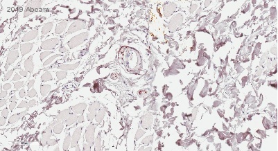 Immunohistochemistry (Formalin/PFA-fixed paraffin-embedded sections) - Anti-PGP9.5 antibody [EPR4118] - Neuronal Marker (AB108986), expandable thumbnail