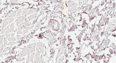 Immunohistochemistry (Formalin/PFA-fixed paraffin-embedded sections) - Anti-PGP9.5 antibody [EPR4118] - Neuronal Marker (AB108986)