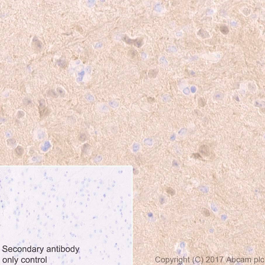 Immunohistochemistry (Formalin/PFA-fixed paraffin-embedded sections) - Anti-PGP9.5 antibody [EPR4118] - Neuronal Marker (ab108986), expandable thumbnail