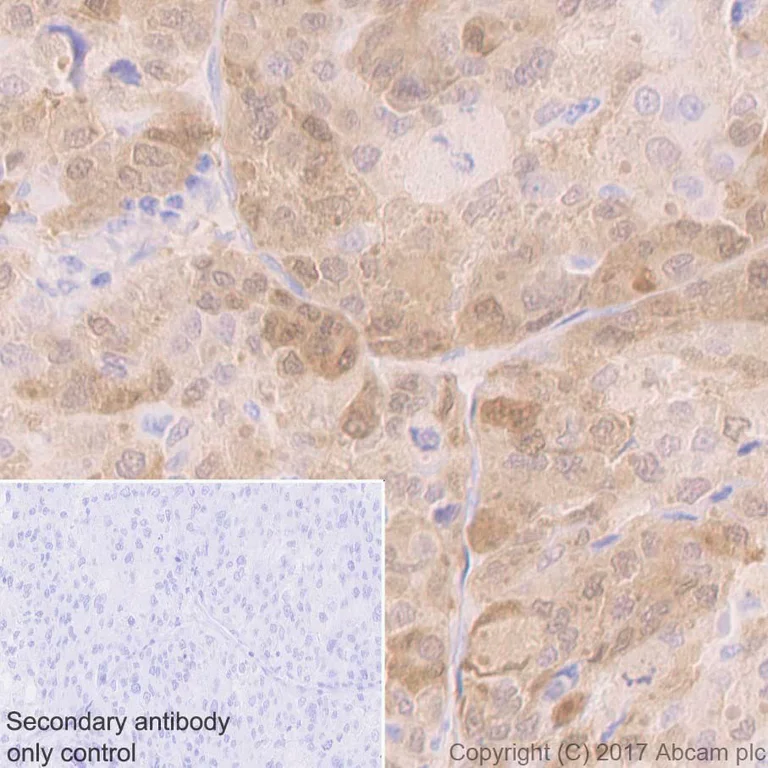 Immunohistochemistry (Formalin/PFA-fixed paraffin-embedded sections) - Anti-PGP9.5 antibody [EPR4118] - Neuronal Marker (AB108986)