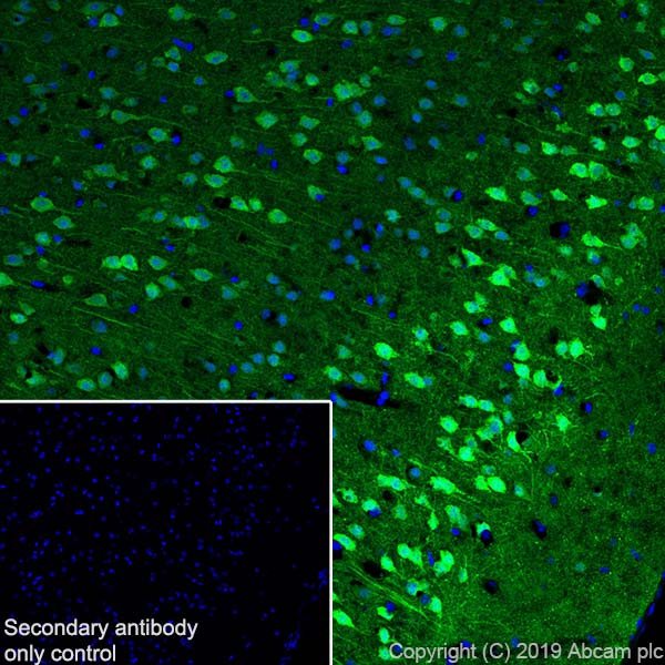 Immunohistochemistry (Frozen sections) - Anti-PGP9.5 antibody [EPR4118] - Neuronal Marker (AB108986), expandable thumbnail