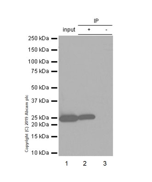 Immunoprecipitation - Anti-PGP9.5 antibody [EPR4118] - Neuronal Marker (AB108986), expandable thumbnail